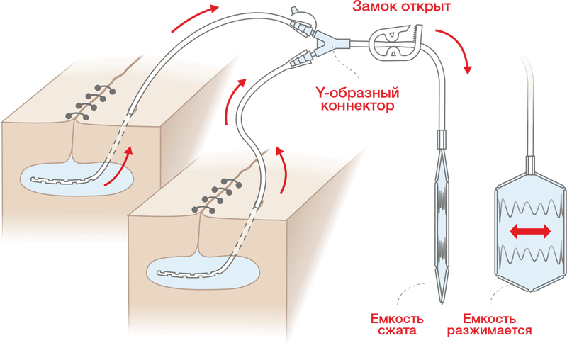Схема работы Резервуара для дренирования плоский Spring-Vac